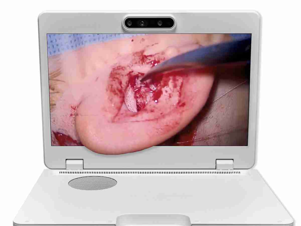 达擎之＂Heads-up 3D显微手术显示系统＂，，整合4K裸眼3D显示及眼球追踪系统，，具备快速追踪人眼移动位置功能，，，减轻医师长时间维持固定姿势的负担，，让医师能有更宽广清晰的3D立体视野及更舒适的姿势来执行手术。。。。